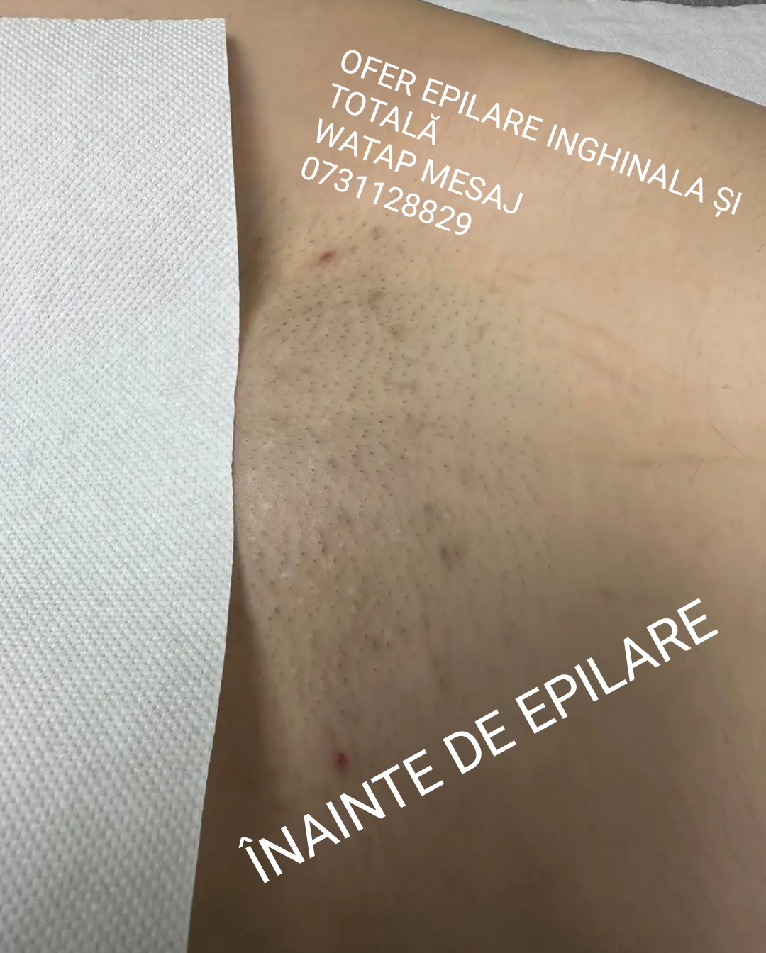 Escorta Oras: Roșiori De Vede - Escorta Telefon: 0731128829 - Servicii Escorta : Buna sunt CLARA BI FEMBOY OFER epilare inghinala definitiv? cu laser , ventuze pentru cervicale, pentru dureri mijloc ?i MASAJ EROTIC NUD CU FINALI. . . . . . B?RBA?ILOR CIT SI FETELOR CA MINE SINGURE SAU C?S?TORITE la domiciliu clientului sau la hotel doar in ro?iori de vede ?i Turnu M?gurele Teleorman ?edin?a epilare inghinala ventuze pentru dureri lombare ?i cervicale ?edin?a de masaj erotic cu final . . . . Detalii watap doar mesaj ok nu r?spund la apeluri Sunt FEMBOY , , Femeie , , din Teleorman am vârsta de 43, caut B?rbat Sunt Femeie din Teleorman am vârsta de 43, caut B?rbat Escorta Oras: Roșiori De Vede - Escorta Telefon: 0731128829 - Servicii Escorta : Buna sunt CLARA BI FEMBOY OFER epilare inghinala definitiv? cu laser , ventuze pentru cervicale, pentru dureri mijloc ?i MASAJ EROTIC NUD CU FINALI. . . . . . B?RBA?ILOR CIT SI FETELOR CA MINE SINGURE SAU C?S?TORITE la domiciliu clientului sau la hotel doar in ro?iori de vede ?i Turnu M?gurele Teleorman ?edin?a epilare inghinala ventuze pentru dureri lombare ?i cervicale ?edin?a de masaj erotic cu final . . . . Detalii watap doar mesaj ok nu r?spund la apeluri Sunt FEMBOY , , Femeie , , din Teleorman am vârsta de 43, caut B?rbat Sunt Femeie din Teleorman am vârsta de 43, caut B?rbat