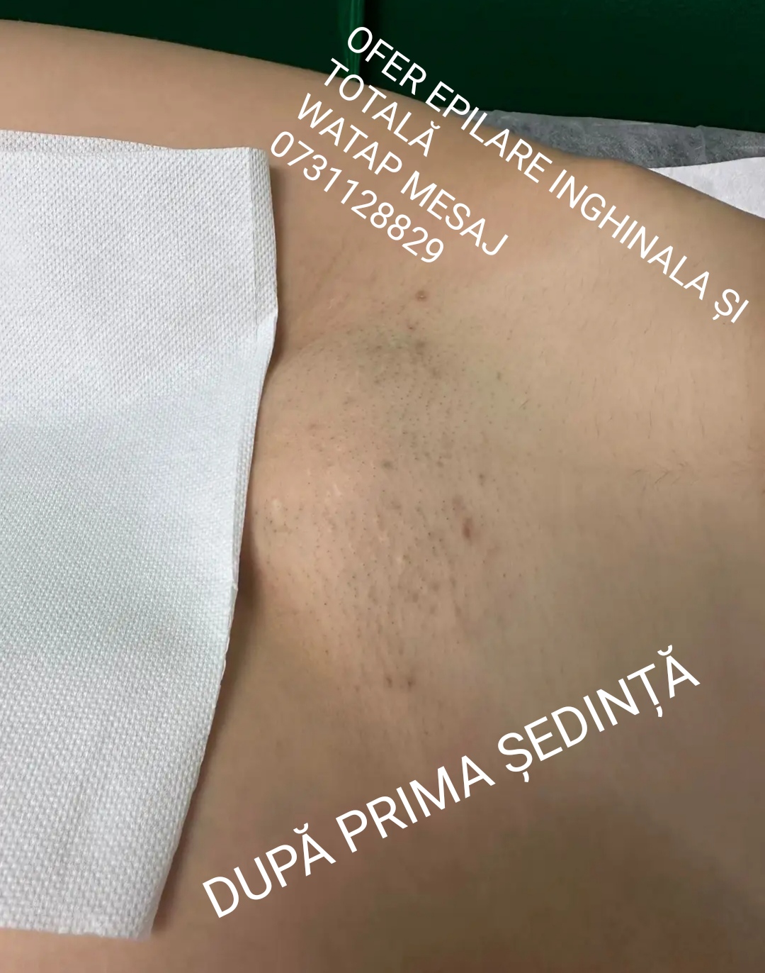 Roșiori De Vede - Escorta Sexy - Buna 
SUNT VALY FEMBOY 
OFER EPILARE INGHINALA DEFINITIVA CU LASER SAU  TOT CORPUL LA DOMICILIU CLIENTULUI SAU LA HOTEL 
IN RO?IORI DE VEDE ?I TURNU M?GURELE 
DETALII WATAP DOAR MESAJ SI SPECIFICATI CA AVE?I NR DE AICI MUL?UMESC FRUMOS