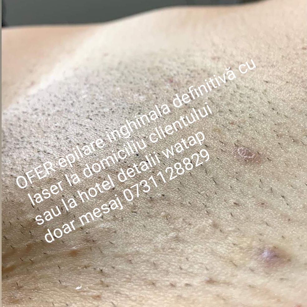 Roșiori De Vede - Escorta Sexy - Buna sunt VALY OFER EPILARE INGHINALA DEFINITIVA CU LASER ?I fesier?  fac doar deplasare la domiciliu clientului sau la hotel in ro?iori de vede ?i Turnu M?gurele Teleorman detalii watap doar mesaj