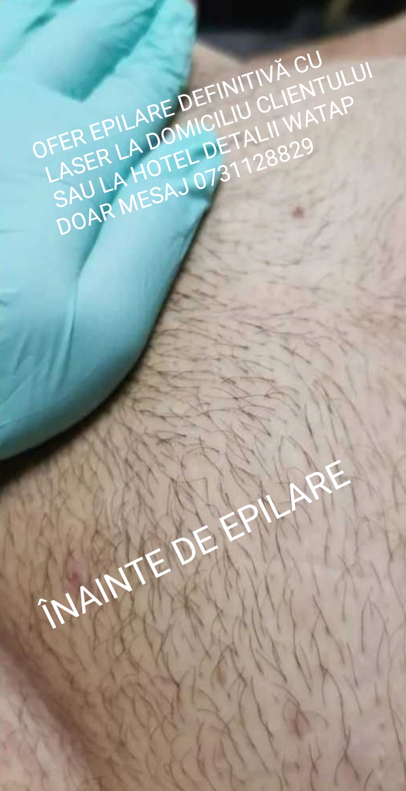 Roșiori De Vede - Escorta Sexy - Buna sunt VALY ACTIV ofer epilare inghinala cu laser la domiciliu clientului sau la hotel in ro?iori de vede ?i Turnu M?gurele Teleorman detalii watap doar mesaj