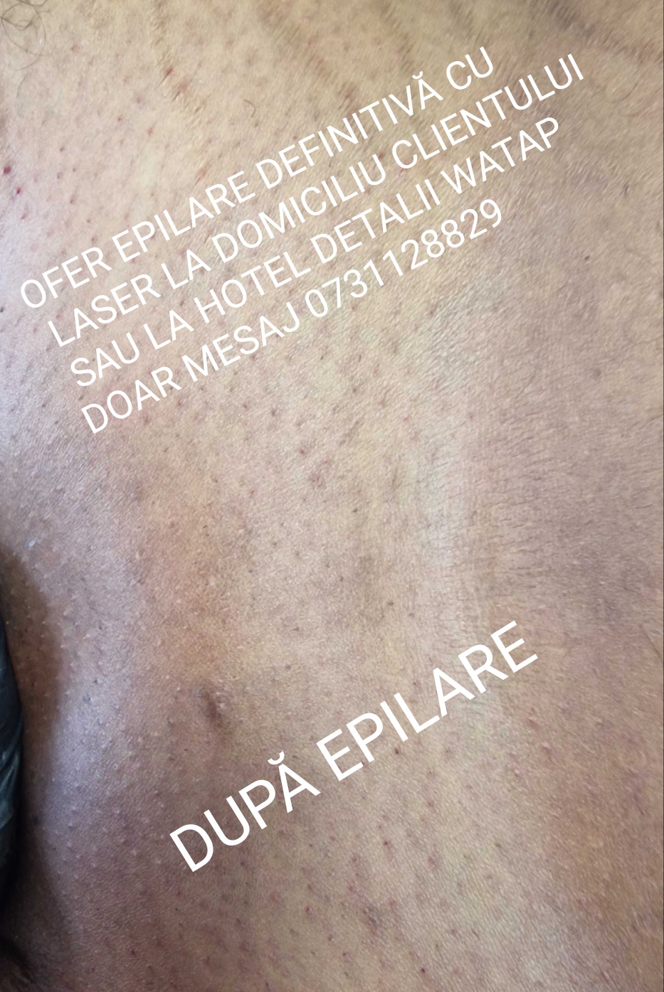 Roșiori De Vede - Escorta Sexy - Buna sunt VALY ACTIV ofer epilare inghinala cu laser la domiciliu clientului sau la hotel in ro?iori de vede ?i Turnu M?gurele Teleorman detalii watap doar mesaj