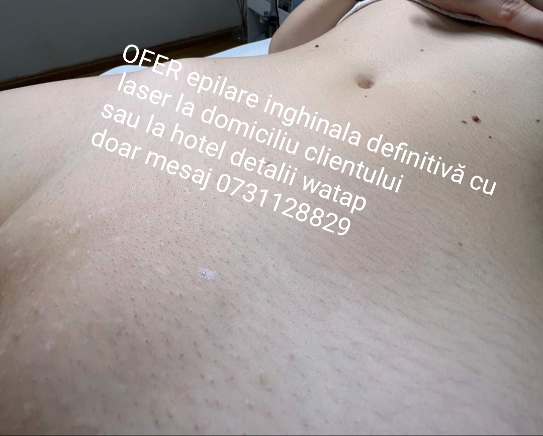 Roșiori De Vede - Escorta Sexy - Buna sunt VALY ACTIV ofer epilare inghinala cu laser la domiciliu clientului sau la hotel in ro?iori de vede ?i Turnu M?gurele Teleorman detalii watap doar mesaj