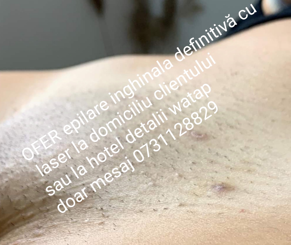 Roșiori De Vede - Escorta Sexy - Buna sunt VALY ACTIV ofer epilare inghinala cu laser la domiciliu clientului sau la hotel in ro?iori de vede ?i Turnu M?gurele Teleorman detalii watap doar mesaj